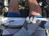 15.25 rbt thumb
