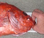 Verm mouth thumb