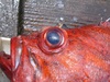 Verm eye thumb